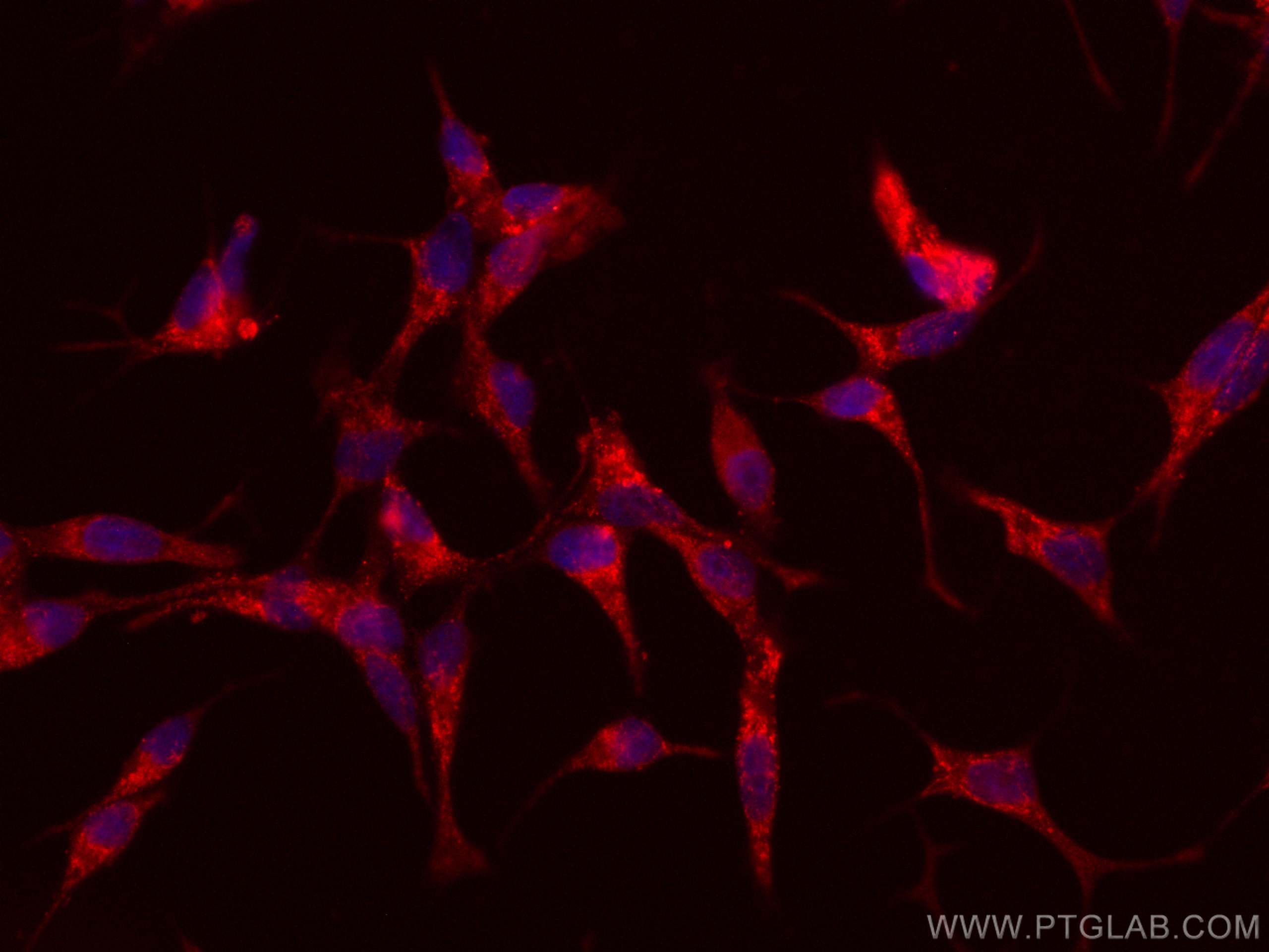 IF Staining of LNCaP using CL594-67607