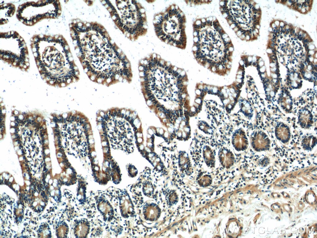 Immunohistochemistry (IHC) staining of human small intestine tissue using FAAH2 Polyclonal antibody (19519-1-AP)