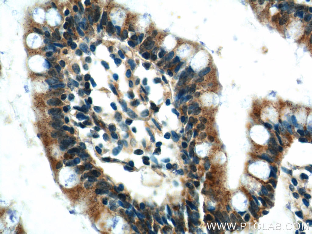 Immunohistochemistry (IHC) staining of human small intestine tissue using FAAH2 Polyclonal antibody (19519-1-AP)