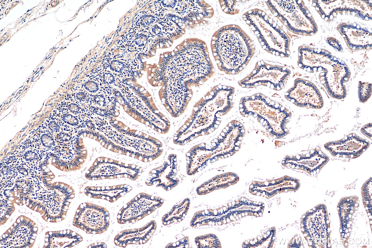 Immunohistochemistry (IHC) staining of human small intestine tissue using FAAH2 Polyclonal antibody (19519-1-AP)