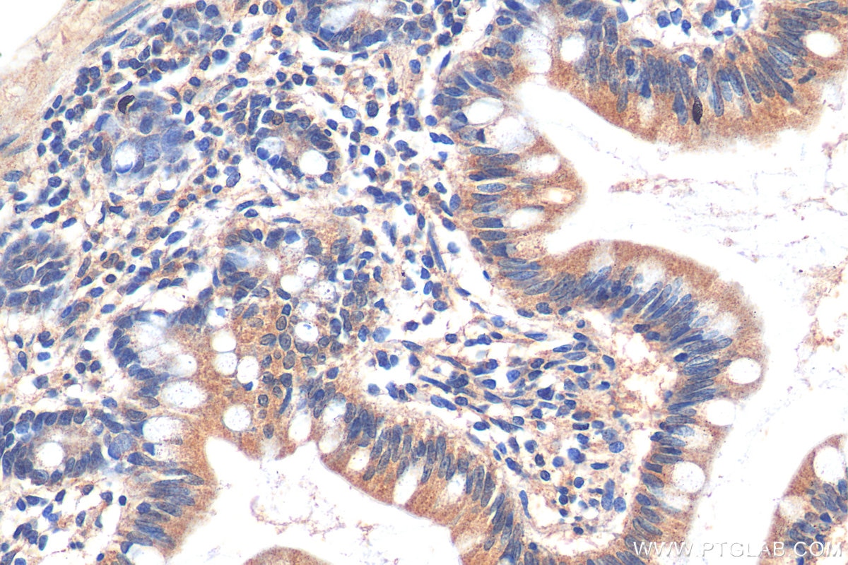 Immunohistochemistry (IHC) staining of human small intestine tissue using FAAH2 Polyclonal antibody (19519-1-AP)