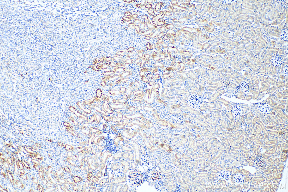 Immunohistochemistry (IHC) staining of mouse kidney tissue using FAAH2 Polyclonal antibody (19519-1-AP)