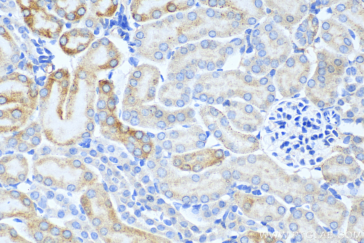 Immunohistochemistry (IHC) staining of mouse kidney tissue using FAAH2 Polyclonal antibody (19519-1-AP)