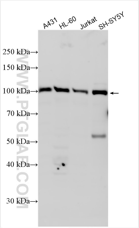 Western Blot (WB) analysis of various lysates using FAAP100 Polyclonal antibody (31841-1-AP)