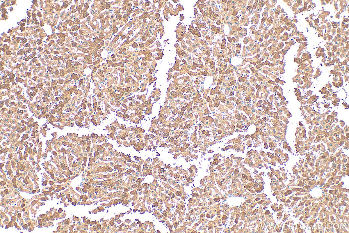 Immunohistochemistry (IHC) staining of mouse liver tissue using FABP1 Polyclonal antibody (13626-1-AP)