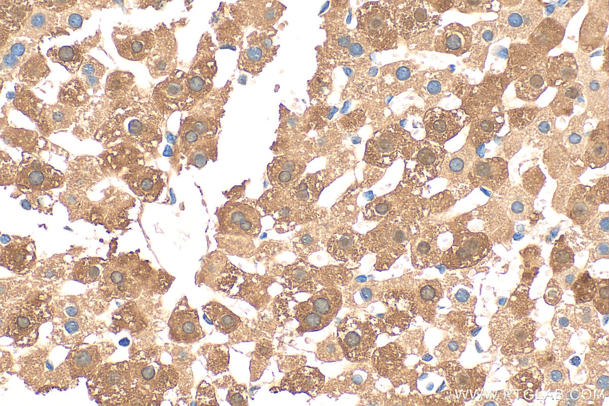 Immunohistochemistry (IHC) staining of mouse liver tissue using FABP1 Polyclonal antibody (13626-1-AP)