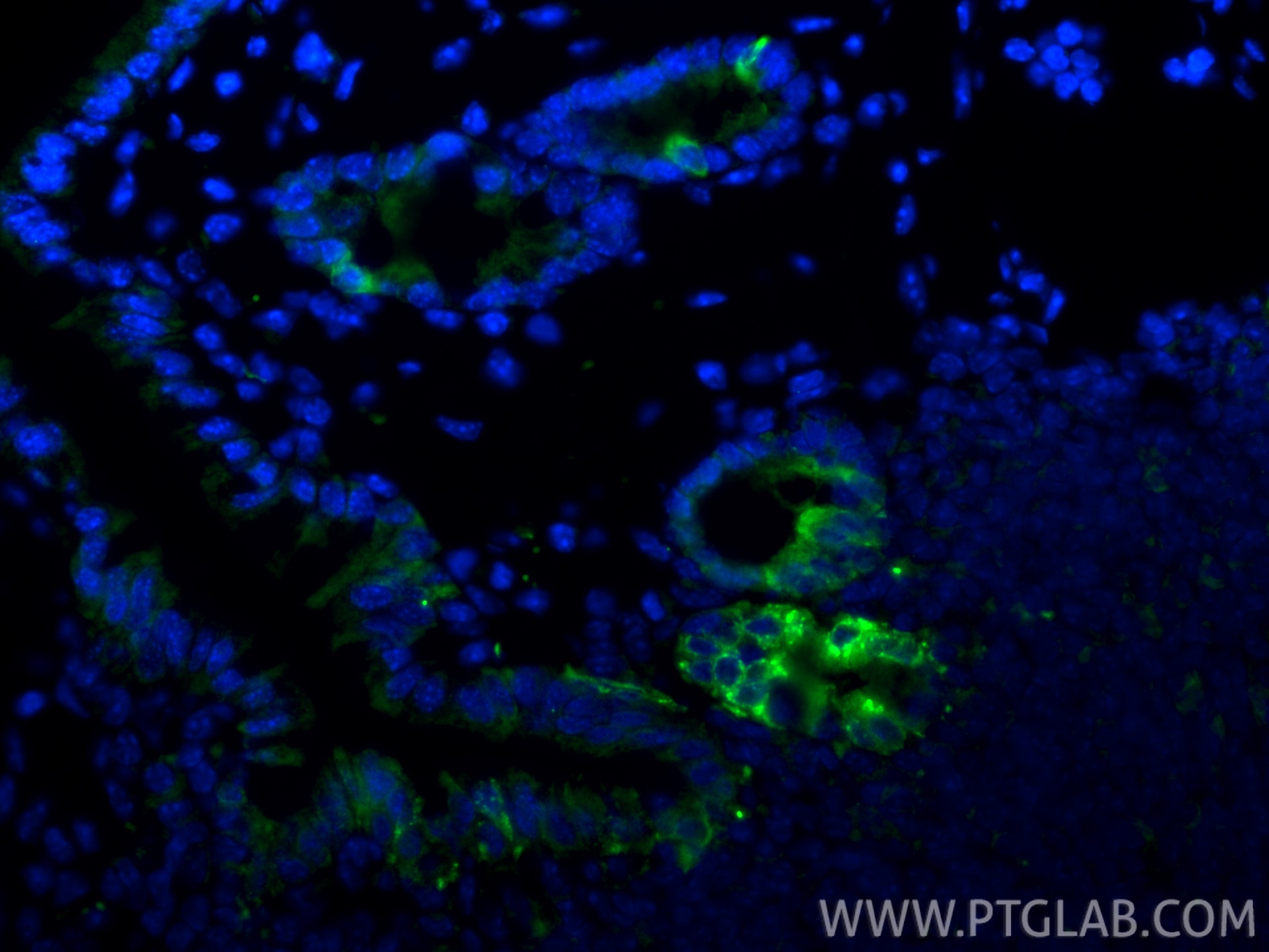 Immunofluorescence (IF) / fluorescent staining of mouse colon tissue using FABP1 Polyclonal antibody (34024-1-AP)