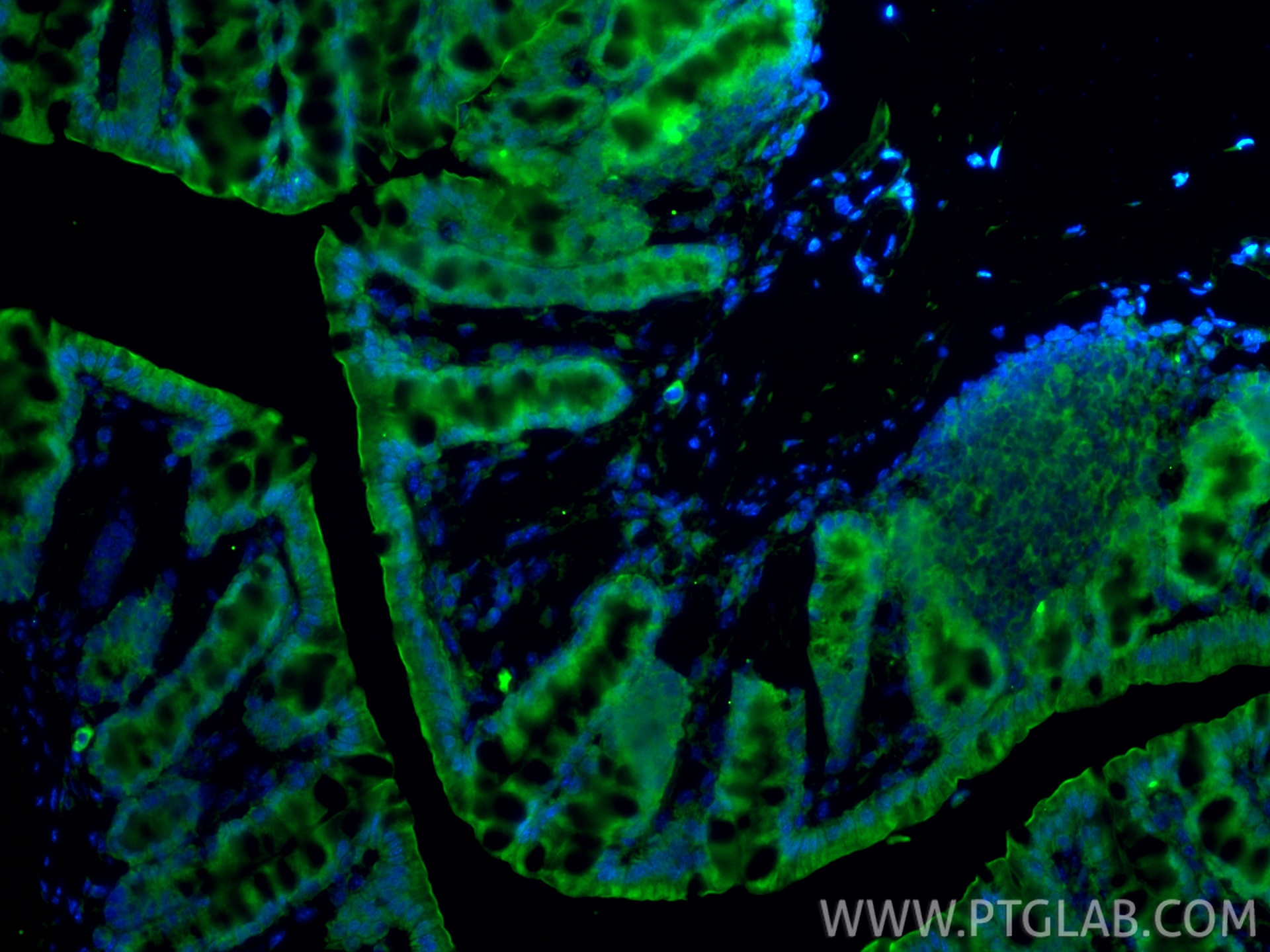 Immunofluorescence (IF) / fluorescent staining of mouse colon tissue using FABP1 Polyclonal antibody (34024-1-AP)
