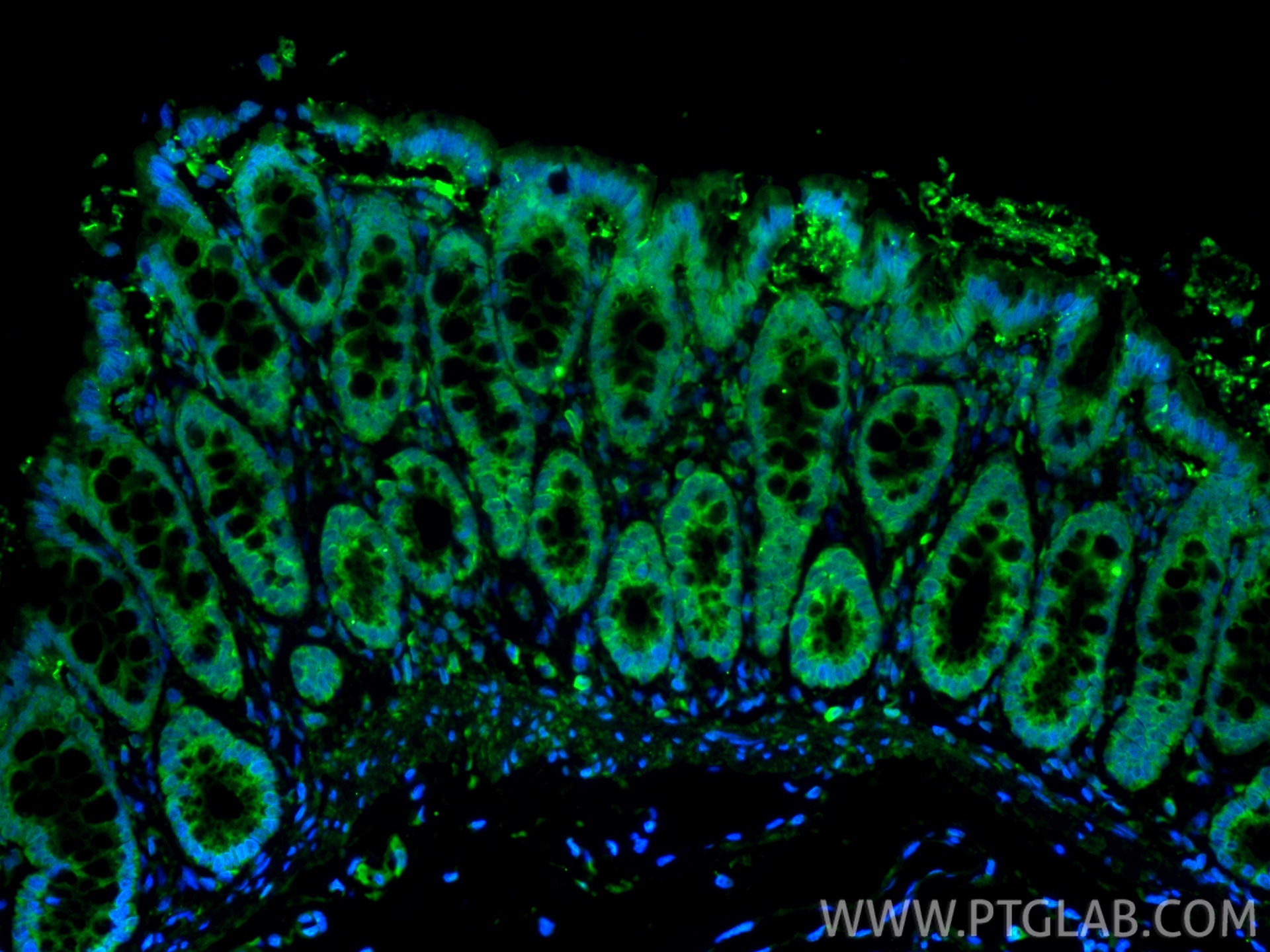 Immunofluorescence (IF) / fluorescent staining of rat colon tissue using FABP1 Polyclonal antibody (34024-1-AP)