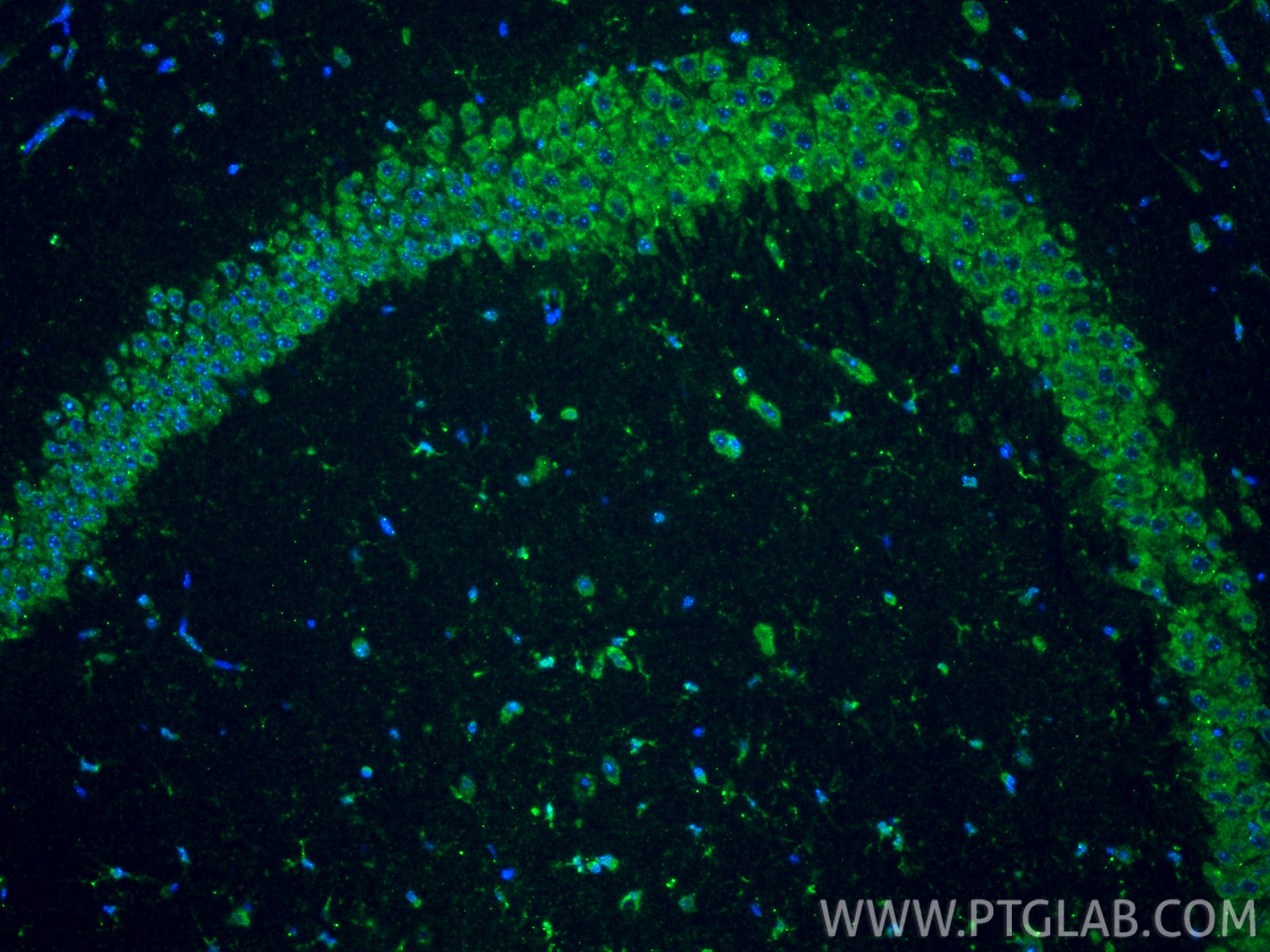 Immunofluorescence (IF) / fluorescent staining of mouse brain tissue using FABP1 Monoclonal antibody (68227-1-Ig)