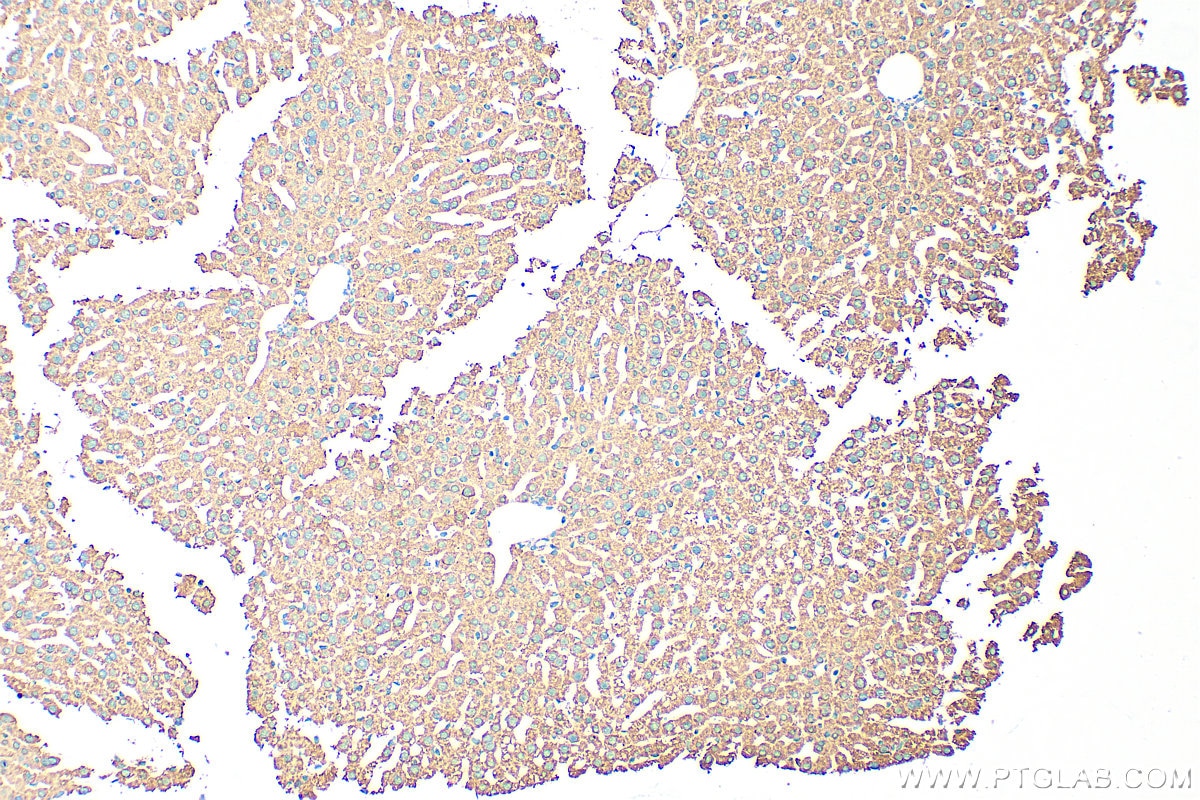 Immunohistochemistry (IHC) staining of mouse liver tissue using FABP1 Monoclonal antibody (68227-1-Ig)