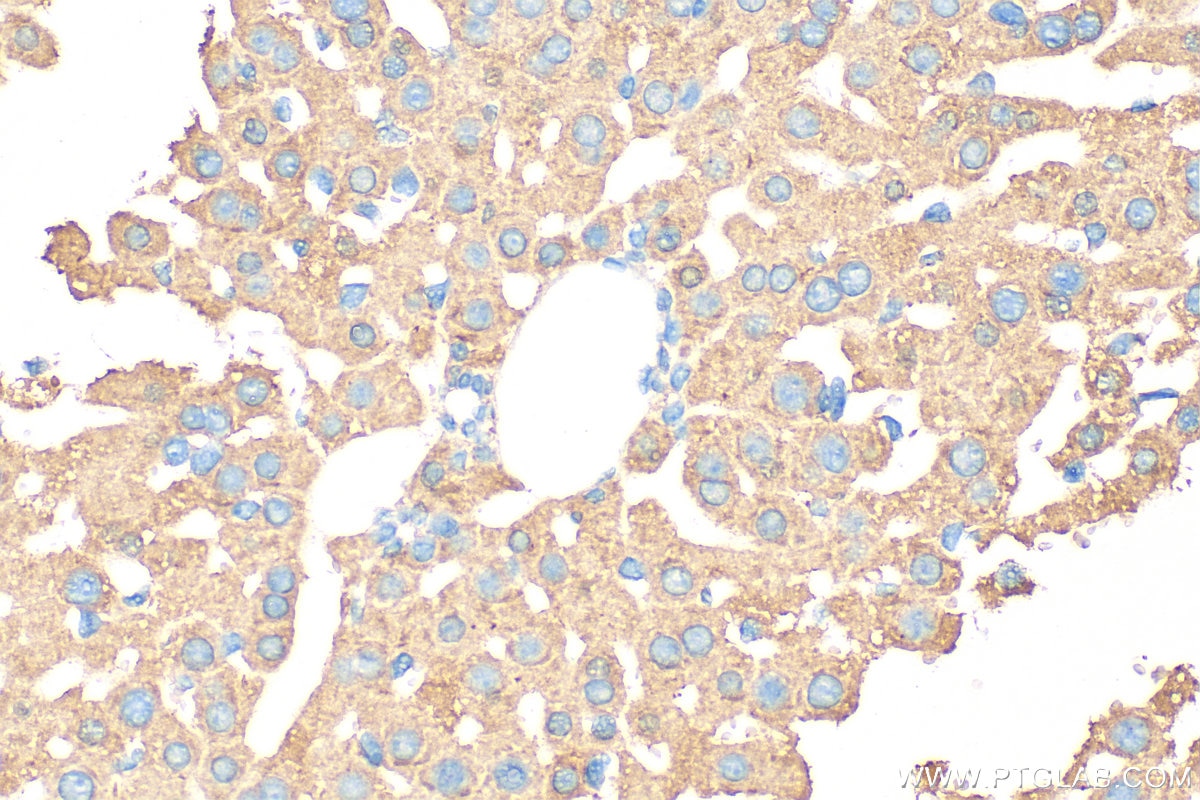 Immunohistochemistry (IHC) staining of mouse liver tissue using FABP1 Monoclonal antibody (68227-1-Ig)