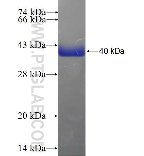 FABP1 fusion protein Ag4540 SDS-PAGE