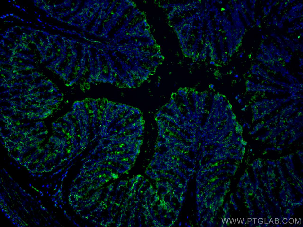 Immunofluorescence (IF) / fluorescent staining of mouse colon tissue using FABP2 Monoclonal antibody (67691-1-Ig)