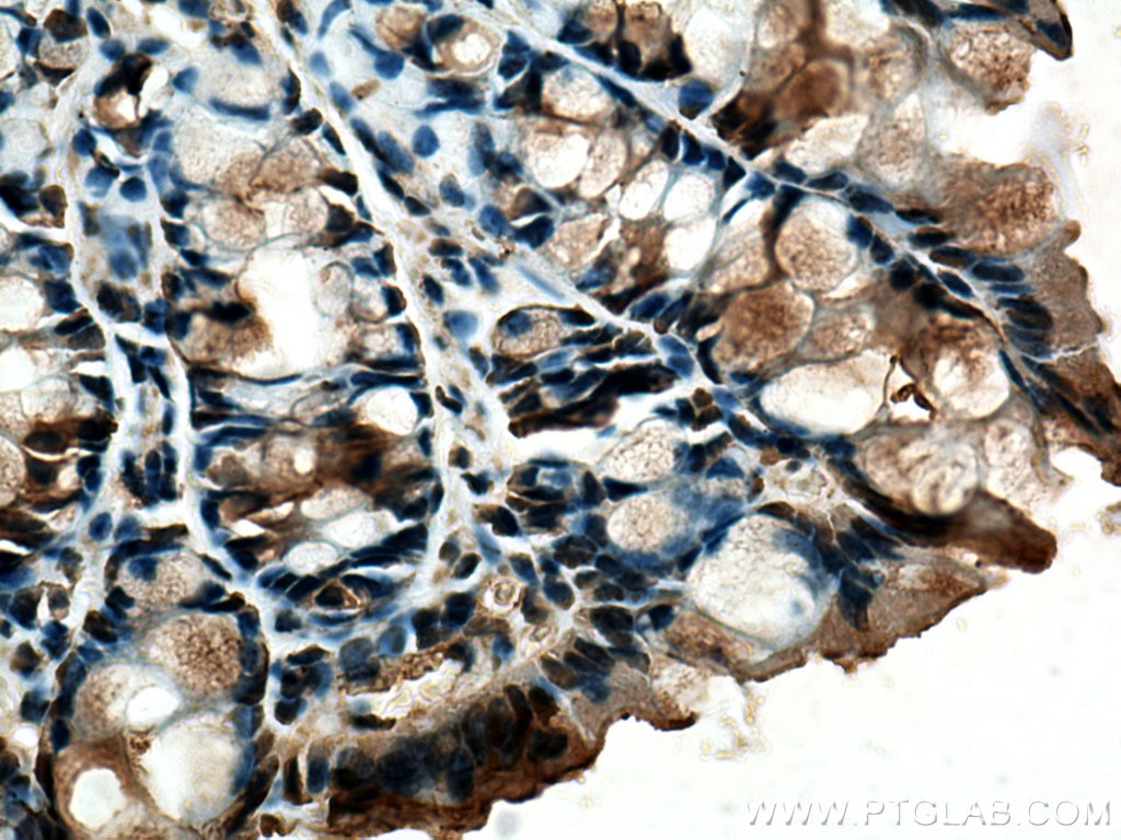 Immunohistochemistry (IHC) staining of mouse colon tissue using FABP2 Monoclonal antibody (67691-1-Ig)