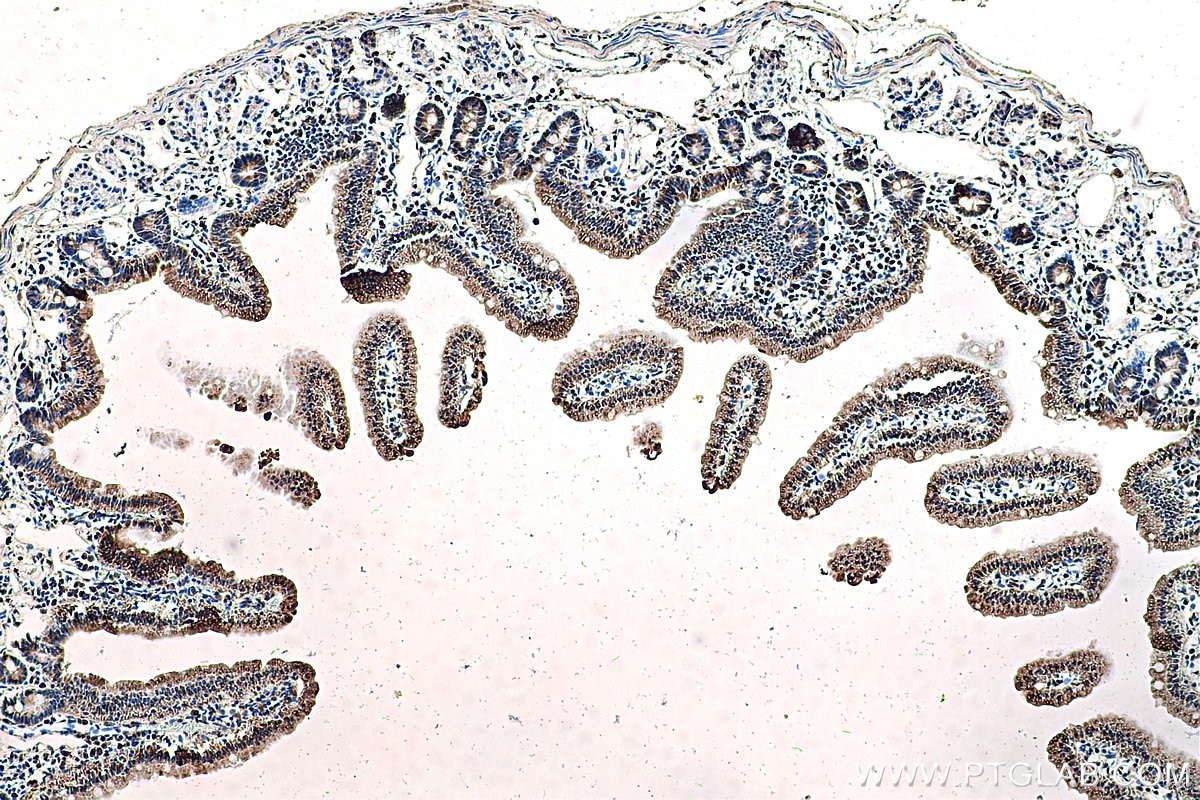 Immunohistochemistry (IHC) staining of mouse small intestine tissue using FABP2 Monoclonal antibody (67691-1-Ig)