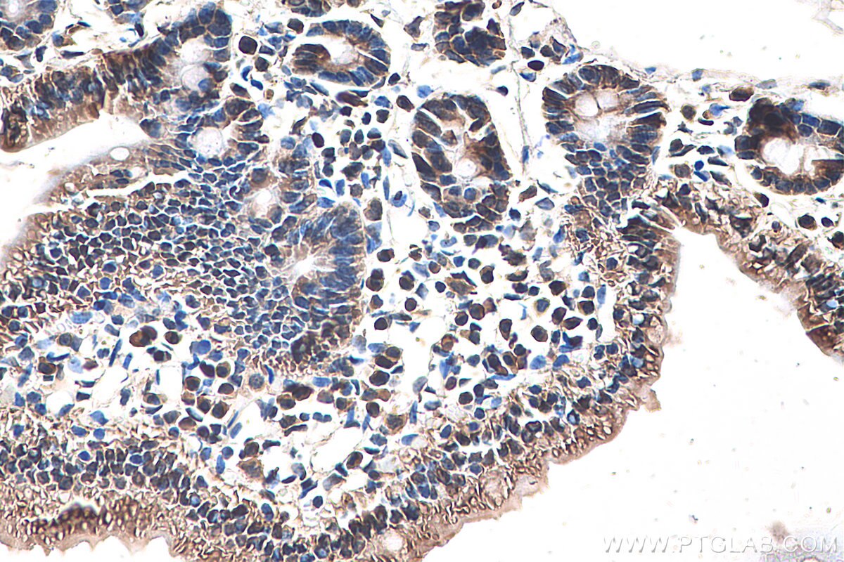 Immunohistochemistry (IHC) staining of mouse small intestine tissue using FABP2 Monoclonal antibody (67691-1-Ig)