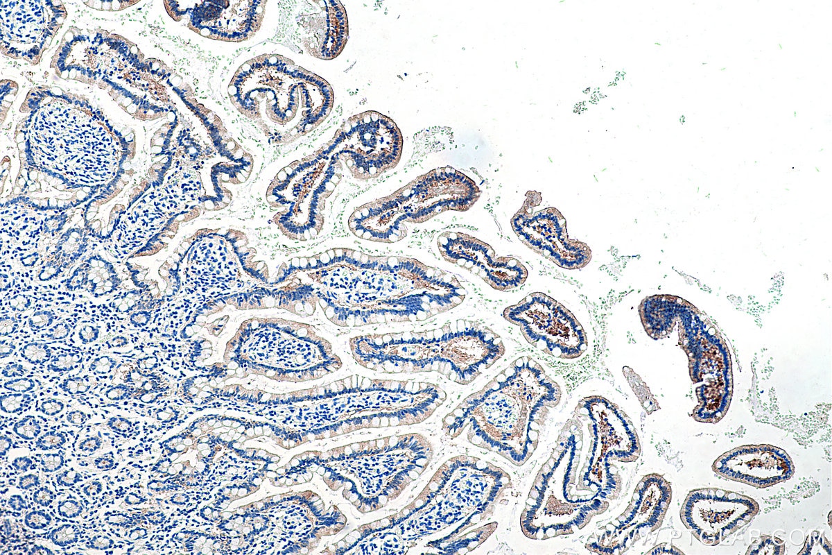 Immunohistochemistry (IHC) staining of human small intestine tissue using FABP2 Monoclonal antibody (67691-1-Ig)