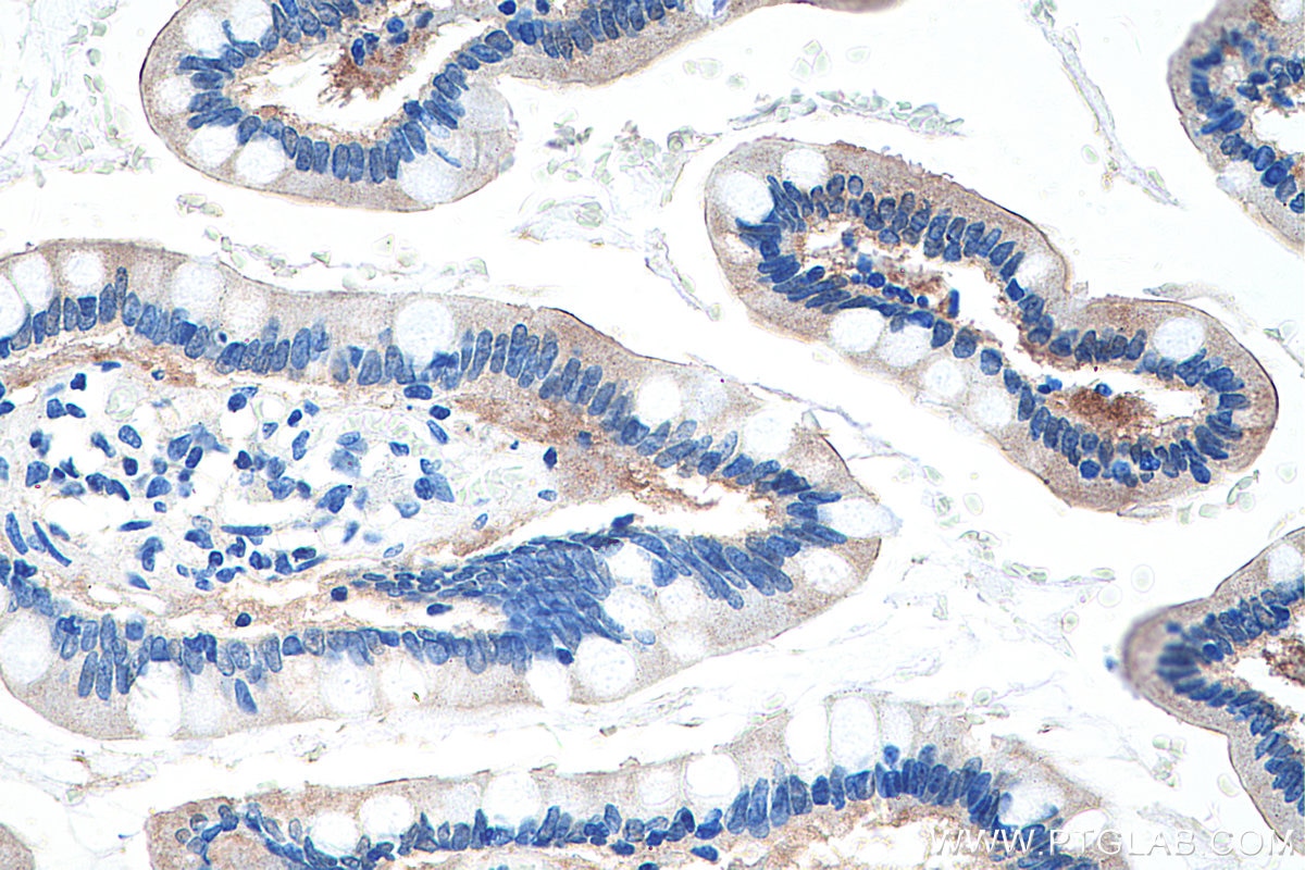 Immunohistochemistry (IHC) staining of human small intestine tissue using FABP2 Monoclonal antibody (67691-1-Ig)