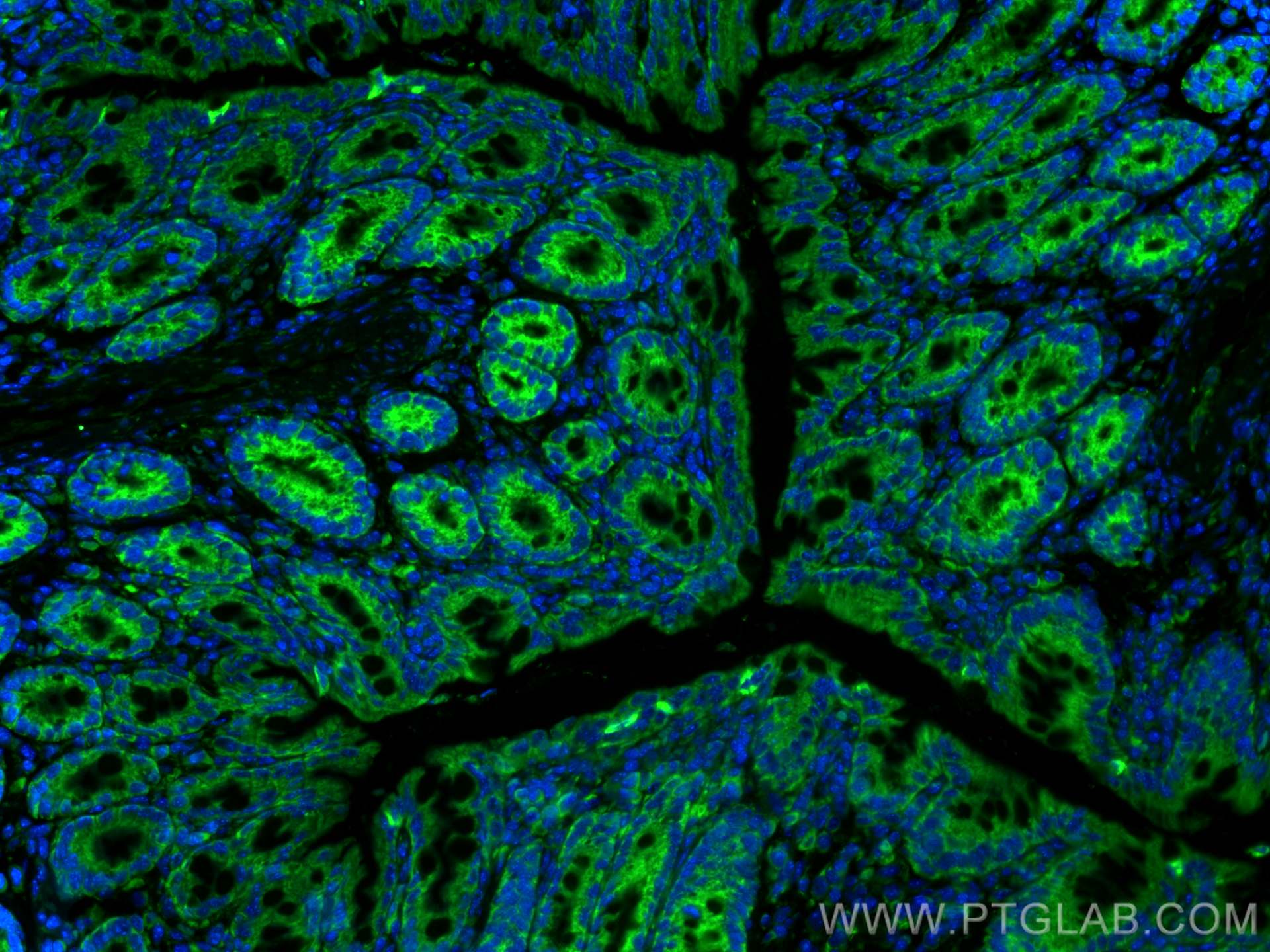 Immunofluorescence (IF) / fluorescent staining of mouse colon tissue using CoraLite® Plus 488-conjugated FABP2 Monoclonal ant (CL488-67691)
