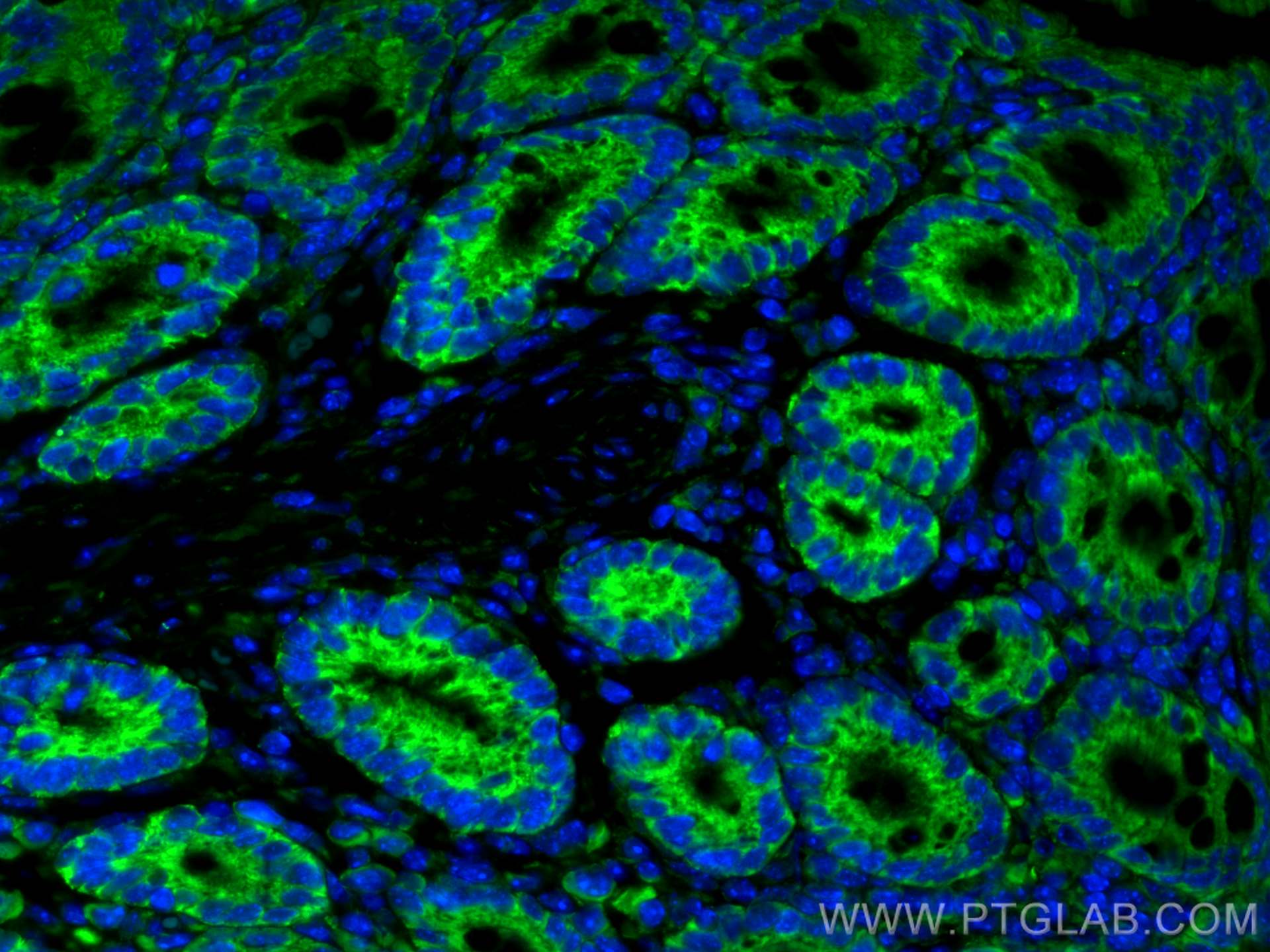 Immunofluorescence (IF) / fluorescent staining of mouse colon tissue using CoraLite® Plus 488-conjugated FABP2 Monoclonal ant (CL488-67691)