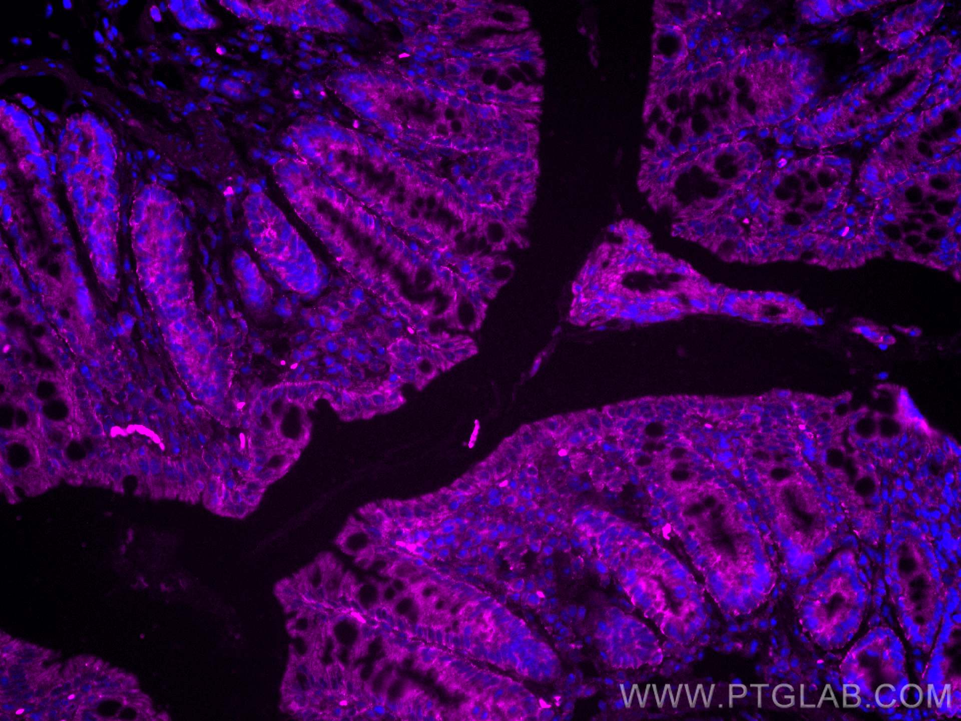 Immunofluorescence (IF) / fluorescent staining of mouse colon tissue using CoraLite® Plus 647-conjugated FABP2 Monoclonal ant (CL647-67691)