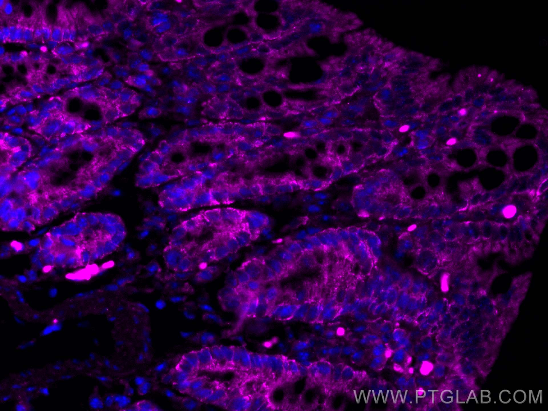 Immunofluorescence (IF) / fluorescent staining of mouse colon tissue using CoraLite® Plus 647-conjugated FABP2 Monoclonal ant (CL647-67691)