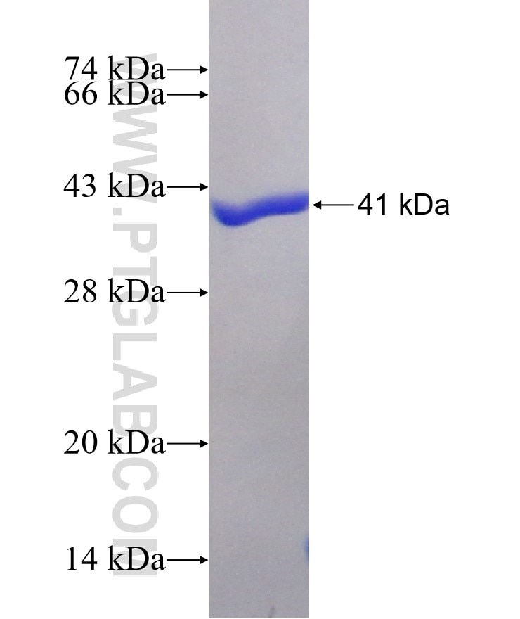 FABP2 fusion protein Ag15793 SDS-PAGE