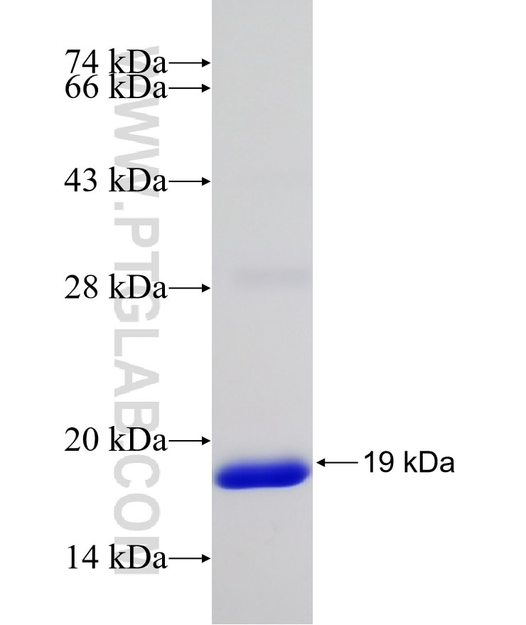 FABP2 fusion protein Ag17620 SDS-PAGE