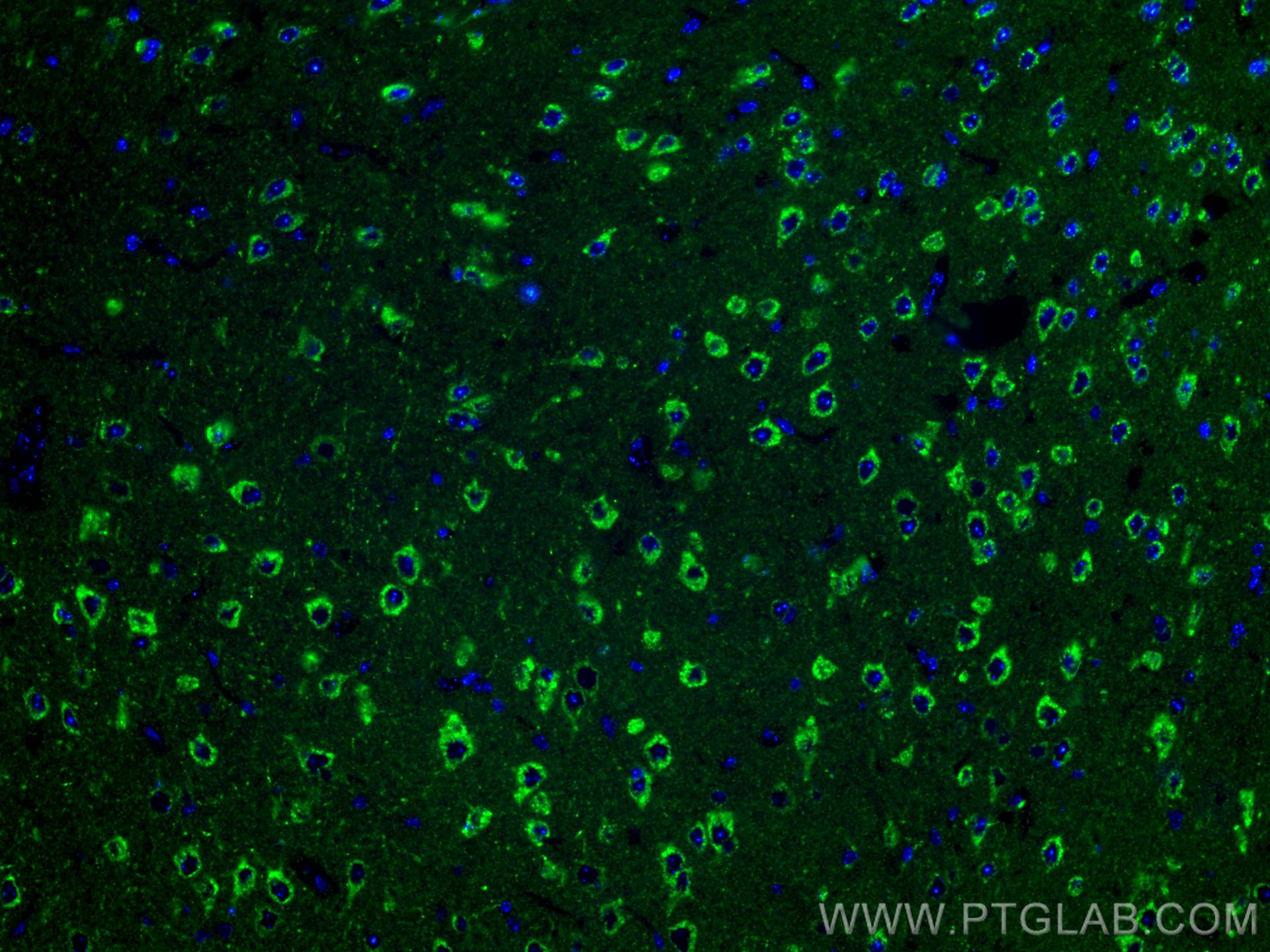 Immunofluorescence (IF) / fluorescent staining of mouse brain tissue using FABP3 Polyclonal antibody (10676-1-AP)