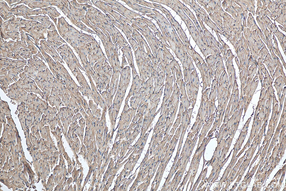 Immunohistochemistry (IHC) staining of mouse heart tissue using FABP3 Polyclonal antibody (10676-1-AP)