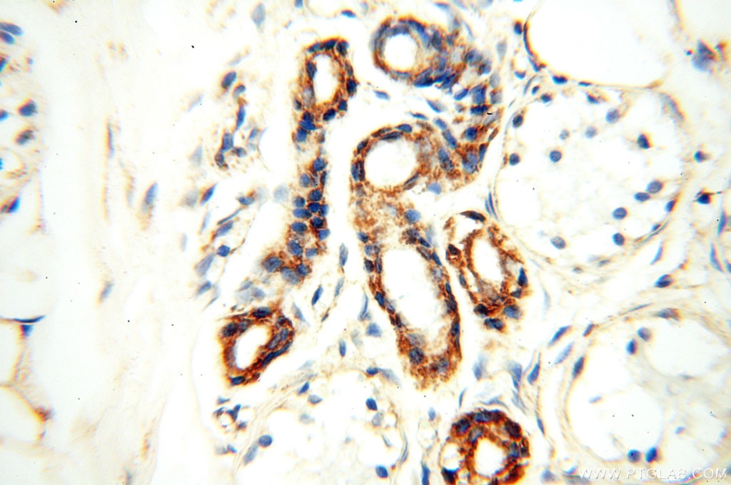 Immunohistochemistry (IHC) staining of human skin tissue using FABP3 Polyclonal antibody (10676-1-AP)