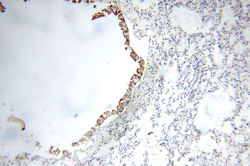 Immunohistochemistry (IHC) staining of human lung tissue using FABP3 Polyclonal antibody (10676-1-AP)