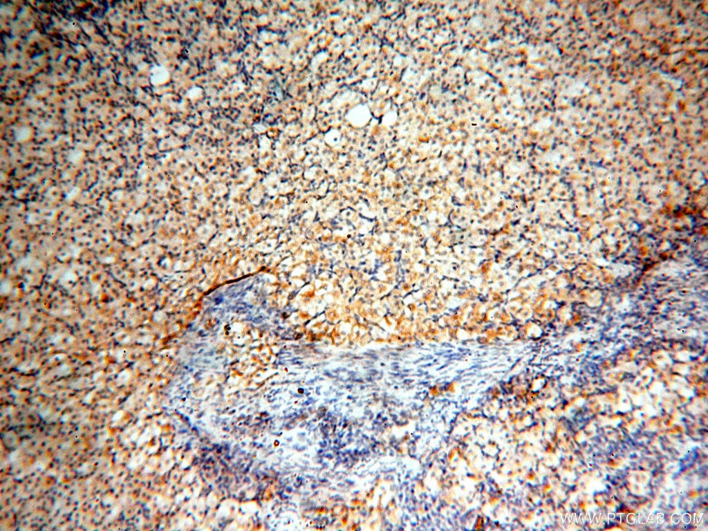 Immunohistochemistry (IHC) staining of human ovary tissue using FABP3 Polyclonal antibody (10676-1-AP)