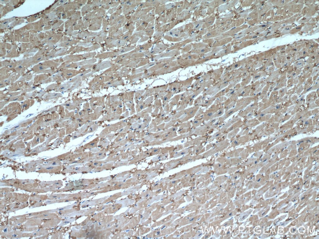 Immunohistochemistry (IHC) staining of human heart tissue using FABP3 Polyclonal antibody (10676-1-AP)