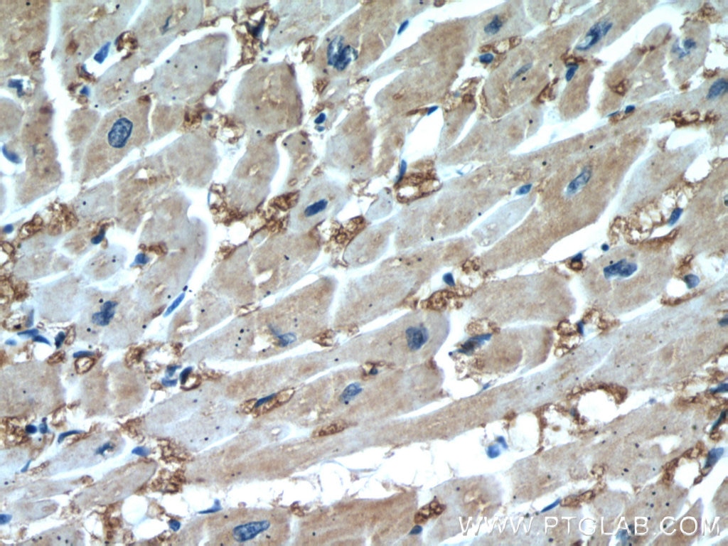 Immunohistochemistry (IHC) staining of human heart tissue using FABP3 Polyclonal antibody (10676-1-AP)