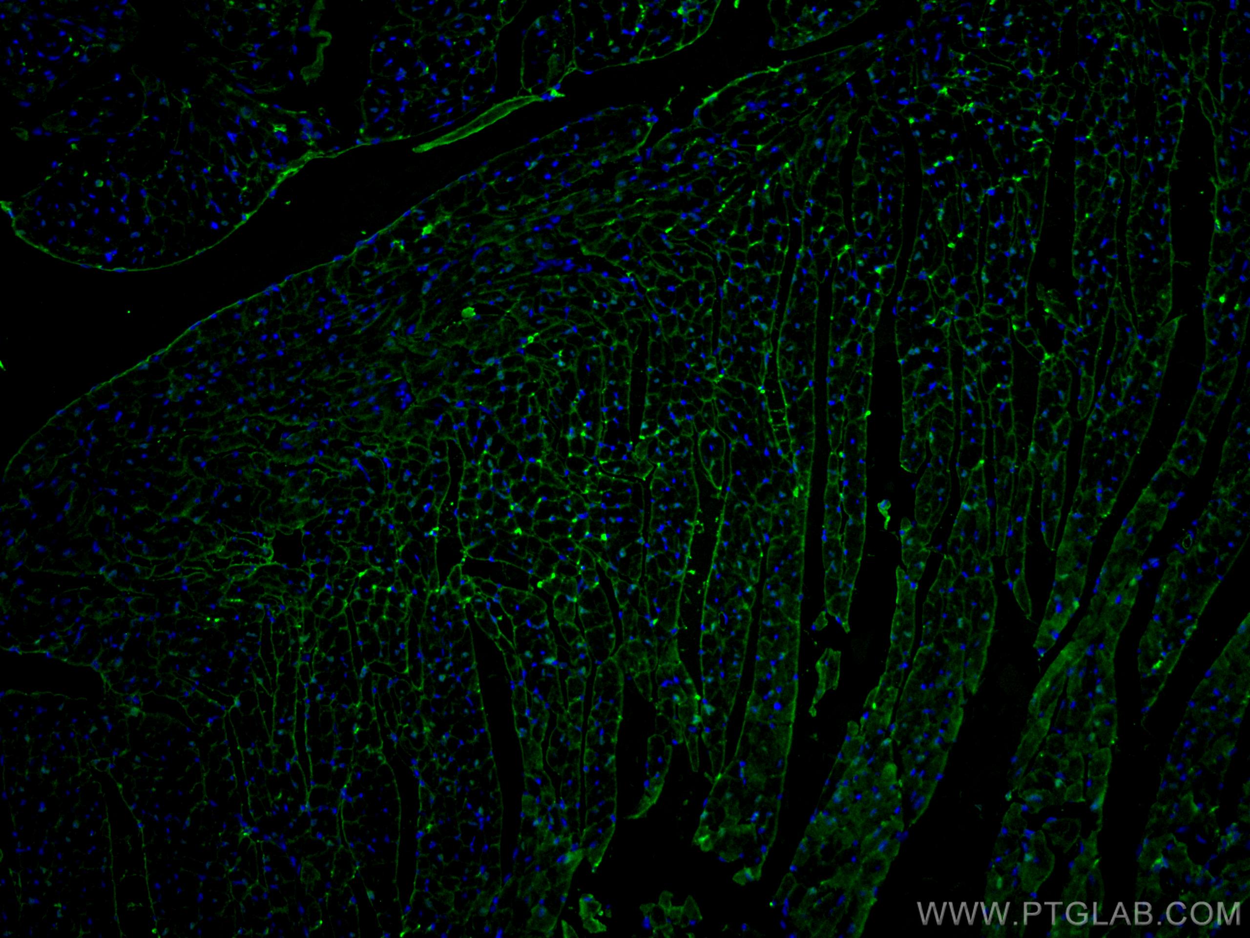 Immunofluorescence (IF) / fluorescent staining of mouse heart tissue using FABP3 Monoclonal antibody (60280-1-Ig)