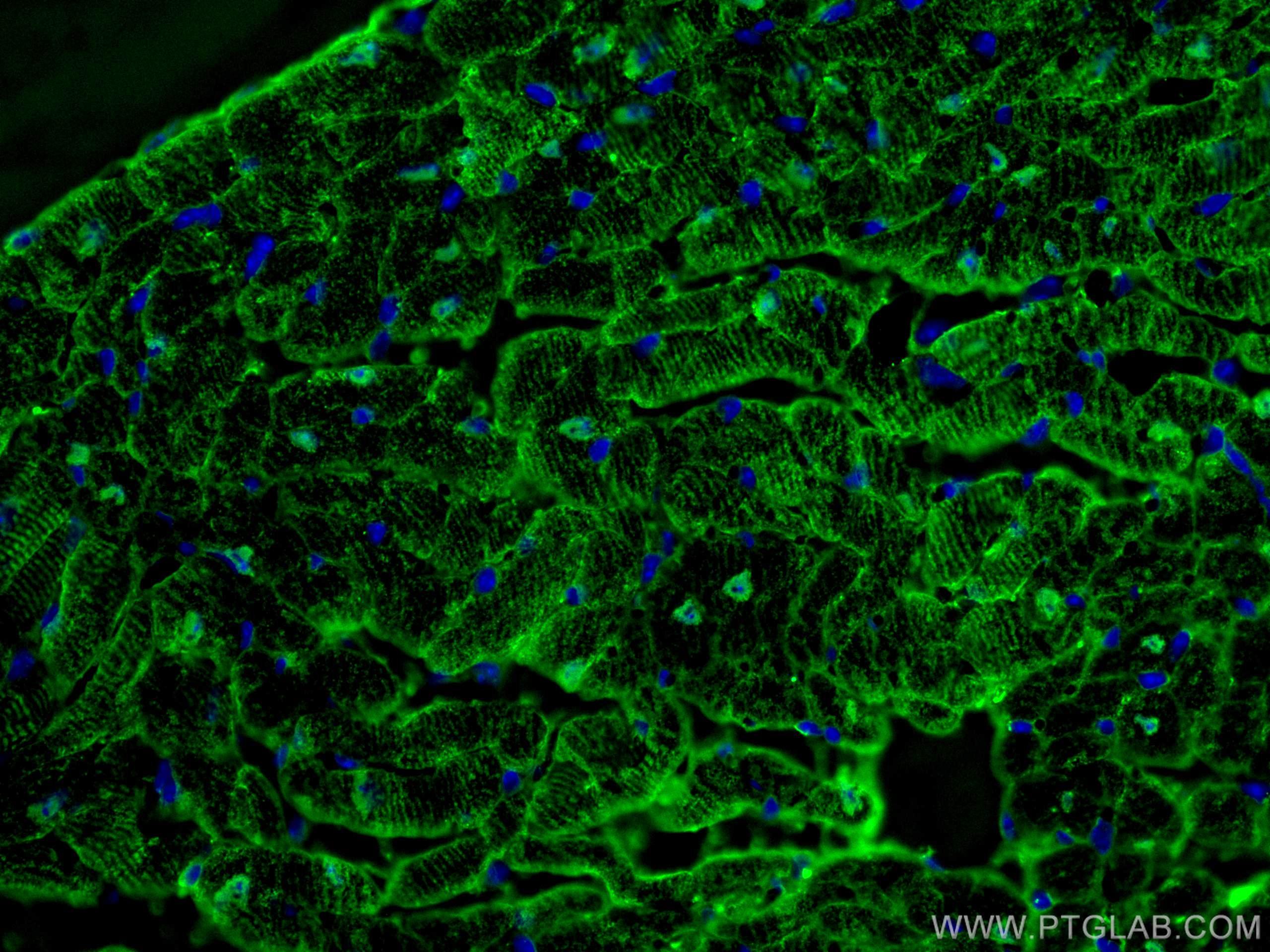 Immunofluorescence (IF) / fluorescent staining of mouse heart tissue using FABP3 Monoclonal antibody (60280-1-Ig)