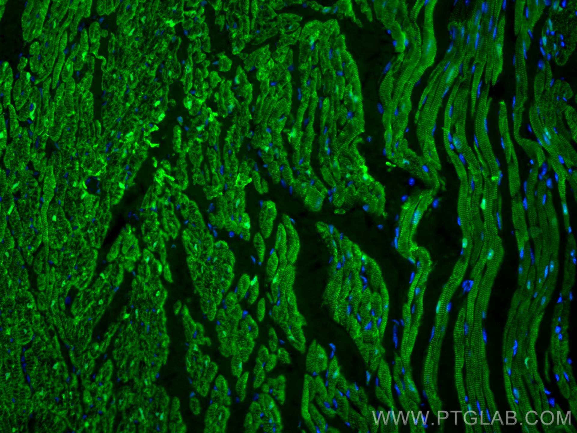 Immunofluorescence (IF) / fluorescent staining of mouse heart tissue using FABP3 Monoclonal antibody (60280-1-Ig)