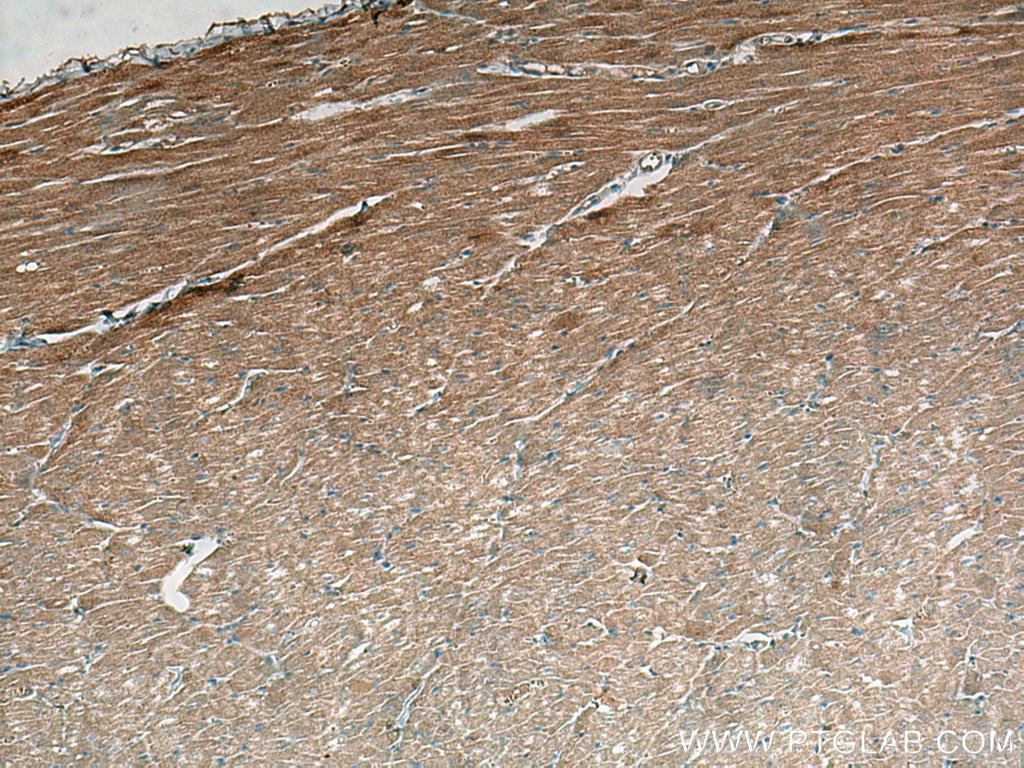 Immunohistochemistry (IHC) staining of human heart tissue using FABP3 Monoclonal antibody (60280-1-Ig)