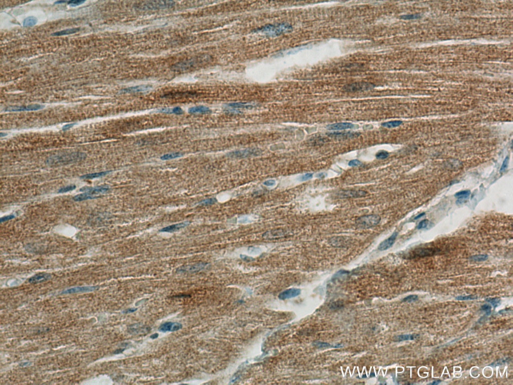 Immunohistochemistry (IHC) staining of human heart tissue using FABP3 Monoclonal antibody (60280-1-Ig)