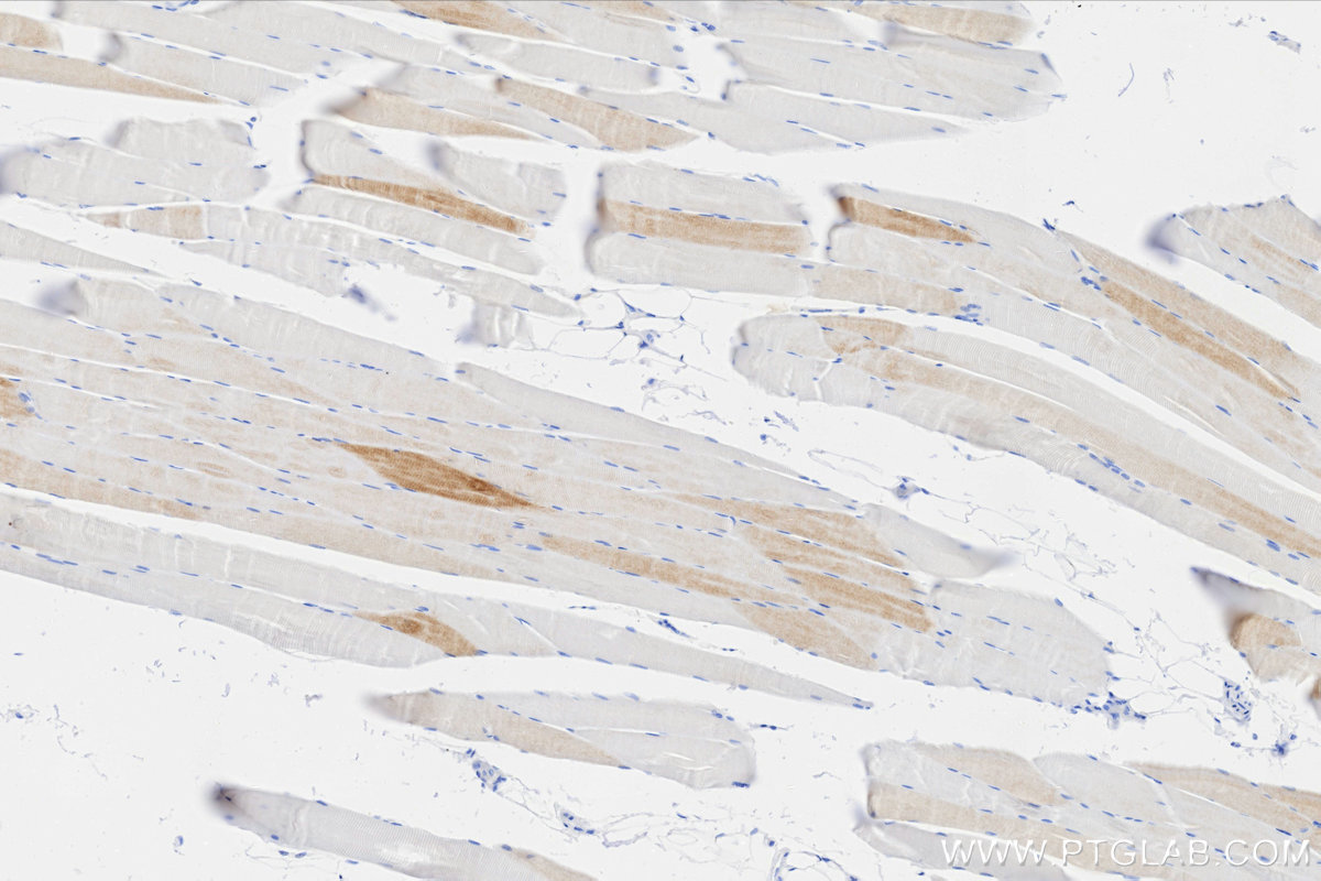 Immunohistochemistry (IHC) staining of human skeletal muscle tissue using FABP3 Recombinant monoclonal antibody (86511-3-RR)