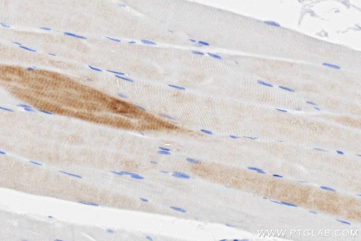 Immunohistochemistry (IHC) staining of human skeletal muscle tissue using FABP3 Recombinant monoclonal antibody (86511-3-RR)