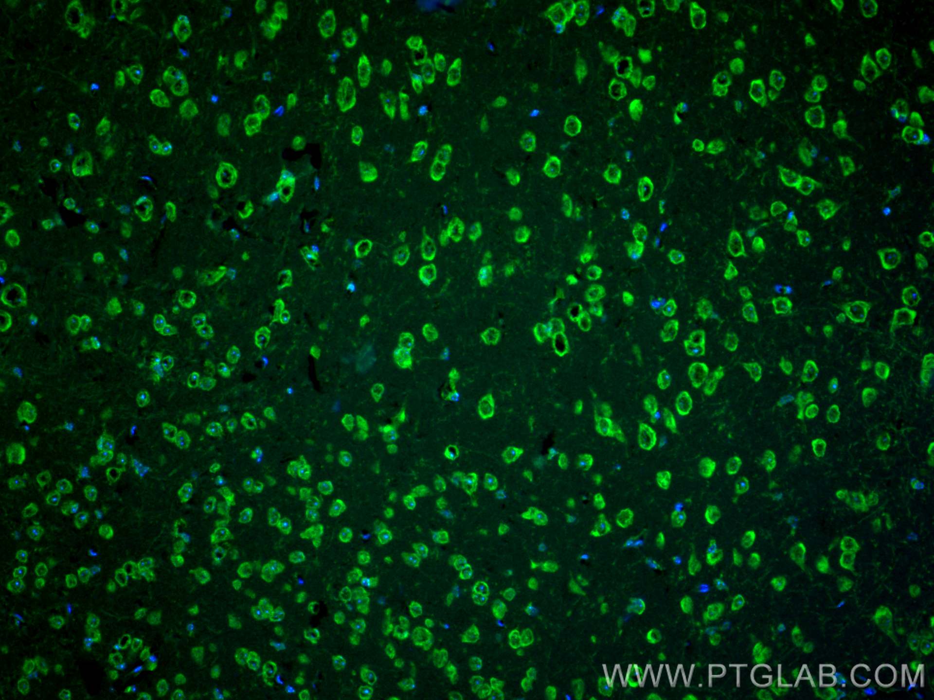 Immunofluorescence (IF) / fluorescent staining of mouse brain tissue using CoraLite® Plus 488-conjugated FABP3 Polyclonal ant (CL488-10676)