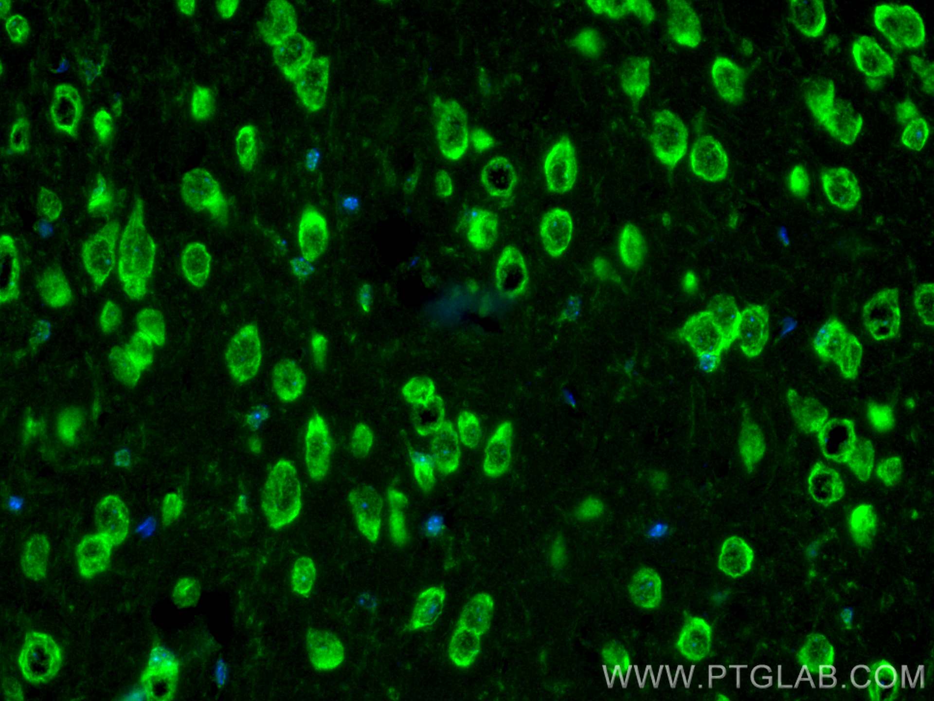 Immunofluorescence (IF) / fluorescent staining of mouse brain tissue using CoraLite® Plus 488-conjugated FABP3 Polyclonal ant (CL488-10676)