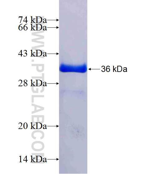 FABP3 fusion protein Ag1069 SDS-PAGE