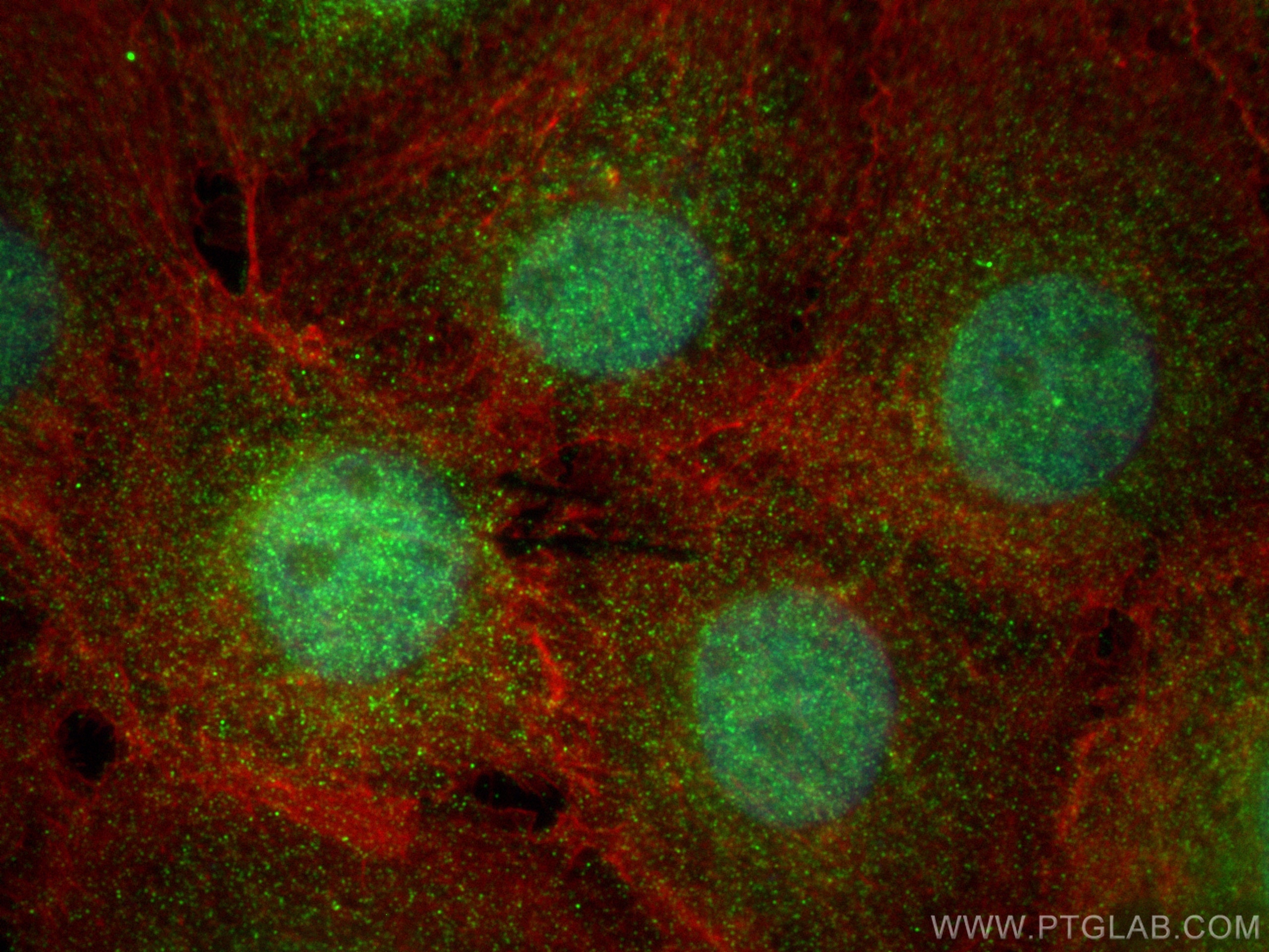 Immunofluorescence (IF) / fluorescent staining of A431 cells using FABP4 Polyclonal antibody (12802-1-AP)