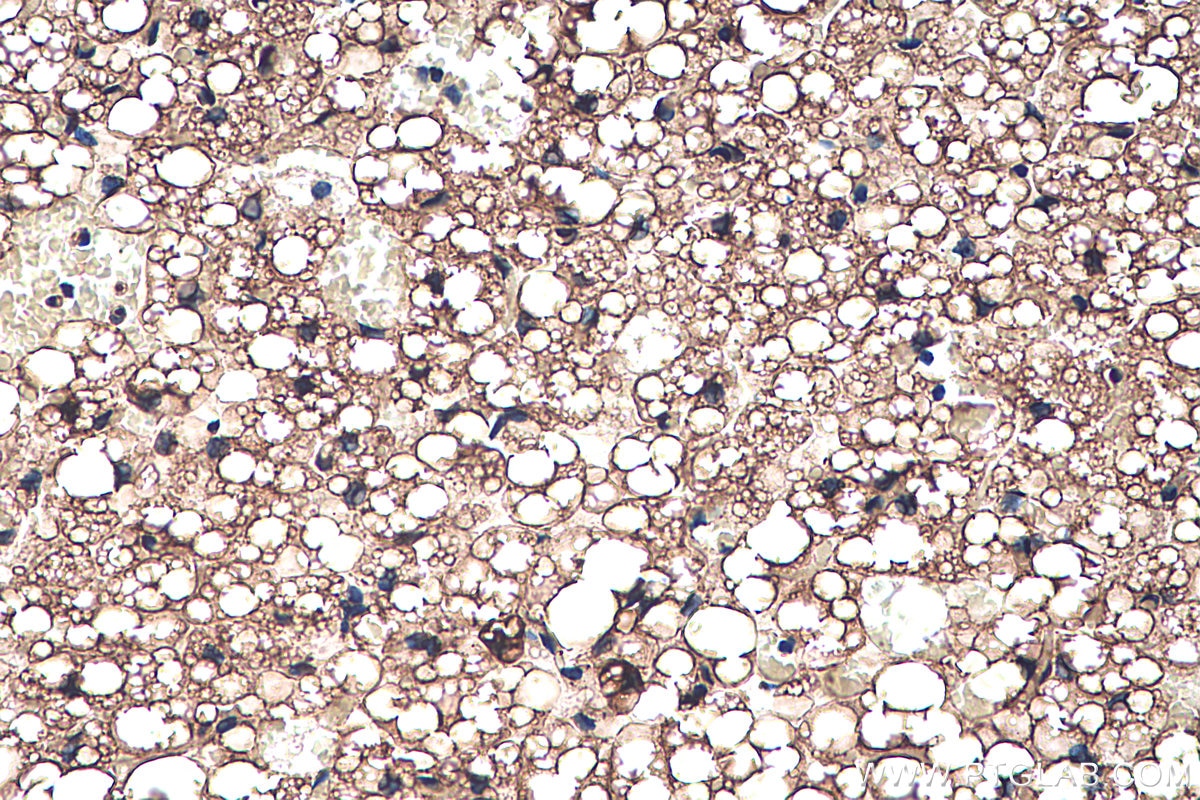 Immunohistochemistry (IHC) staining of rat brown adipose tissue using FABP4 Polyclonal antibody (12802-1-AP)