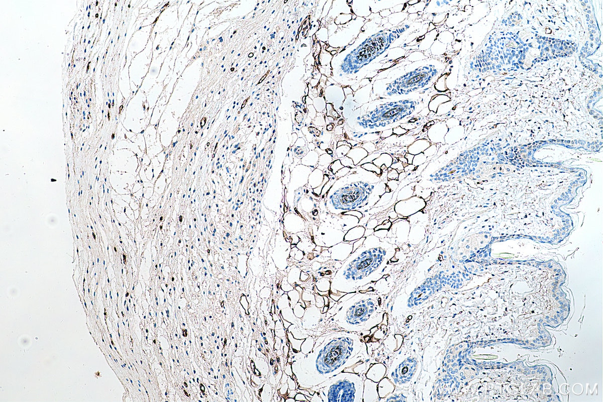 Immunohistochemistry (IHC) staining of mouse skin tissue using FABP4 Polyclonal antibody (12802-1-AP)