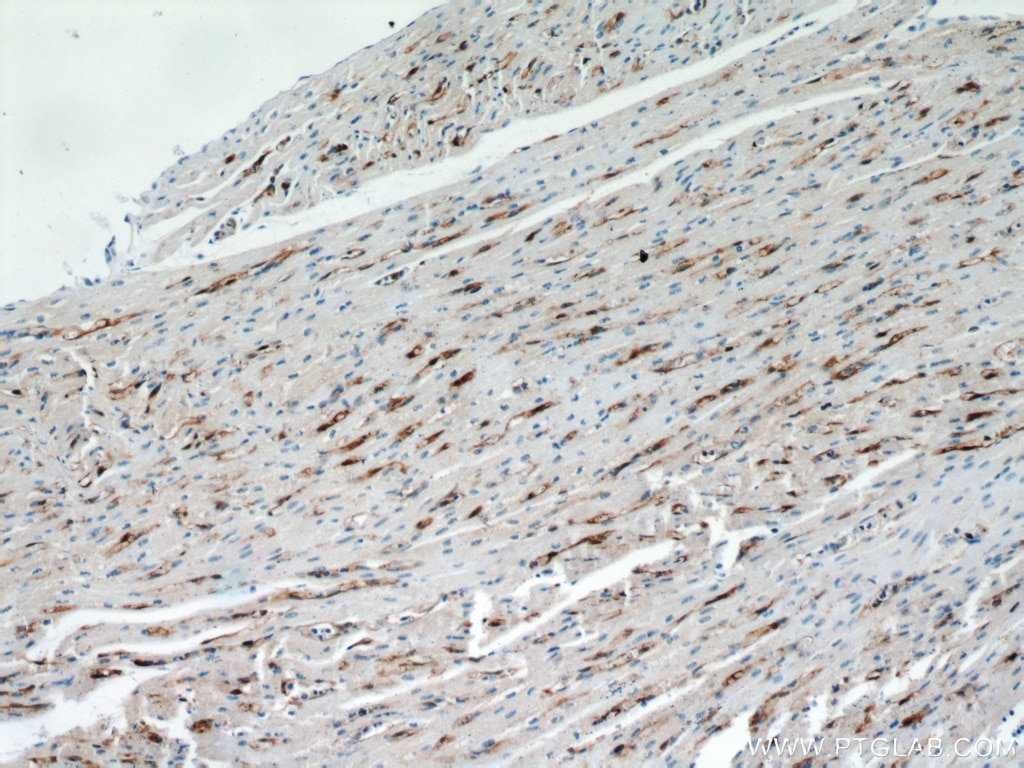 IHC staining of human heart using 12802-1-AP